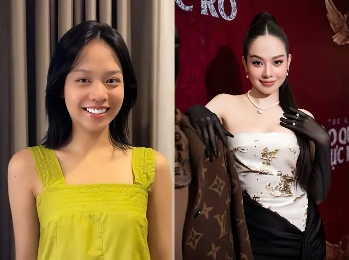 Hoa hậu Thanh Thuỷ trước và sau khi phẫu thuật cải thiện dáng mũi két