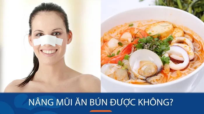 Một trong những câu hỏi phổ biến là liệu sau nâng mũi có thể ăn bún không?