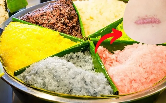 Nhiều người muốn biết sau khi nâng mũi ăn đồ nếp được không?