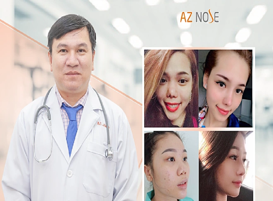 Hình ảnh chân thực của khách hàng khi nâng mũi tại AZ NOSE