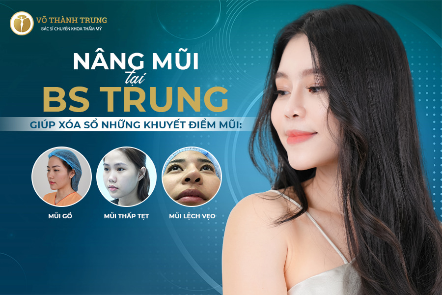 Dịch vụ nâng mũi cải vận tại BS. Võ Thành Trung
