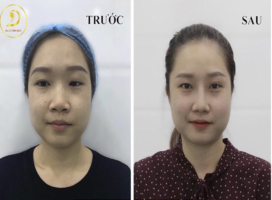 Dr. Lê Trần Duy – Người bạn đồng hành đáng tin cậy trên hành trình hoàn thiện sắc vóc và cải vận
