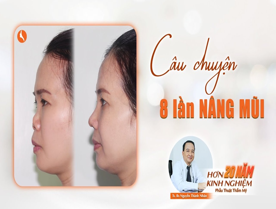 Bác sĩ Nhân và hành trình tái tạo lại chiếc mũi mới