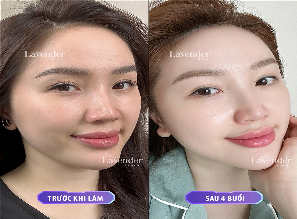 Ca sĩ Bảo Thy đã tin tưởng và lựa chọn Lavender By Chang
