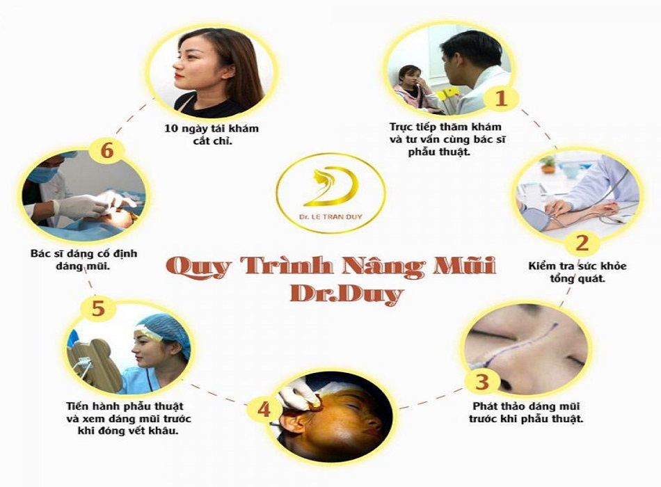 Quy trình nâng mũi chuyên nghiệp, rõ ràng