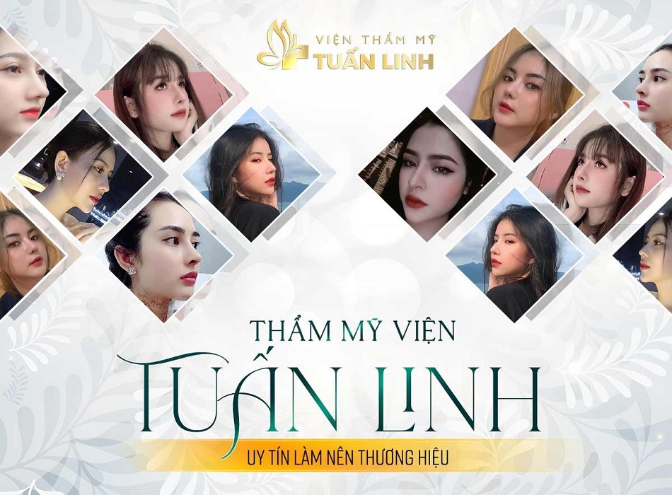 Nhiều phương pháp nâng mũi khác nhau, phù hợp với từng nhu cầu và dáng mũi riêng biệt